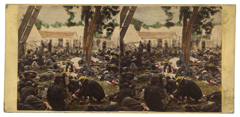 Figure 4: A painted stereograph of wounded Union soldiers taken by James F. Gibson after the Battle of Antietam in September 1862. https://www.loc.gov/pictures/collection/civwar/item/2011646181/